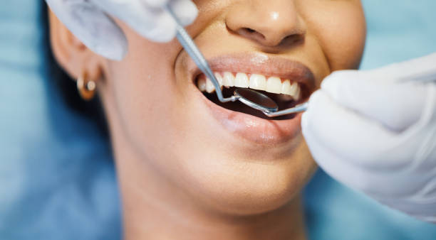 Best Emergency Dental Care for Broken or Chipped Teeth in Marietta, OK