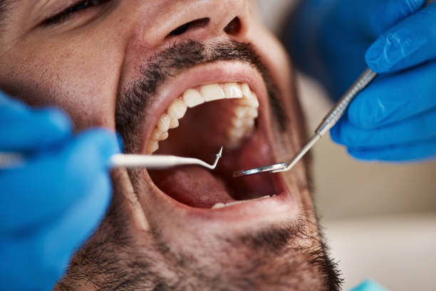 Best Same-Day Emergency Dental Services in Marietta, OK