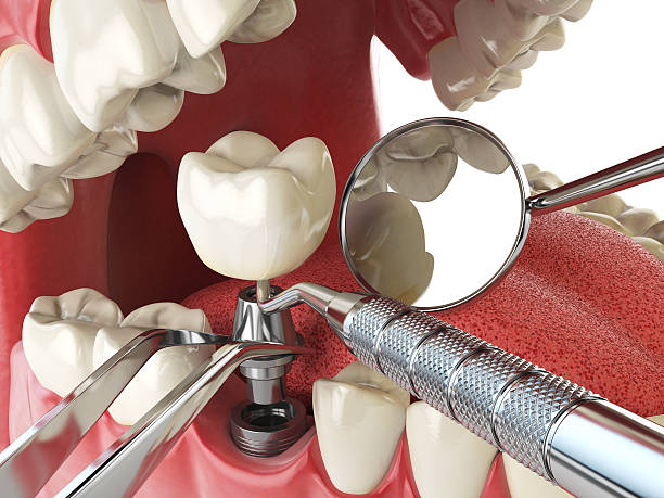 Best Pediatric Emergency Dentist in Marietta, OK
